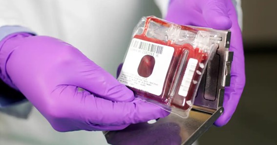 How to Find a Reputable Cord Blood Bank