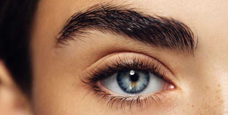 7 Quick Fixes for Puffy Eyes that Work Like Magic